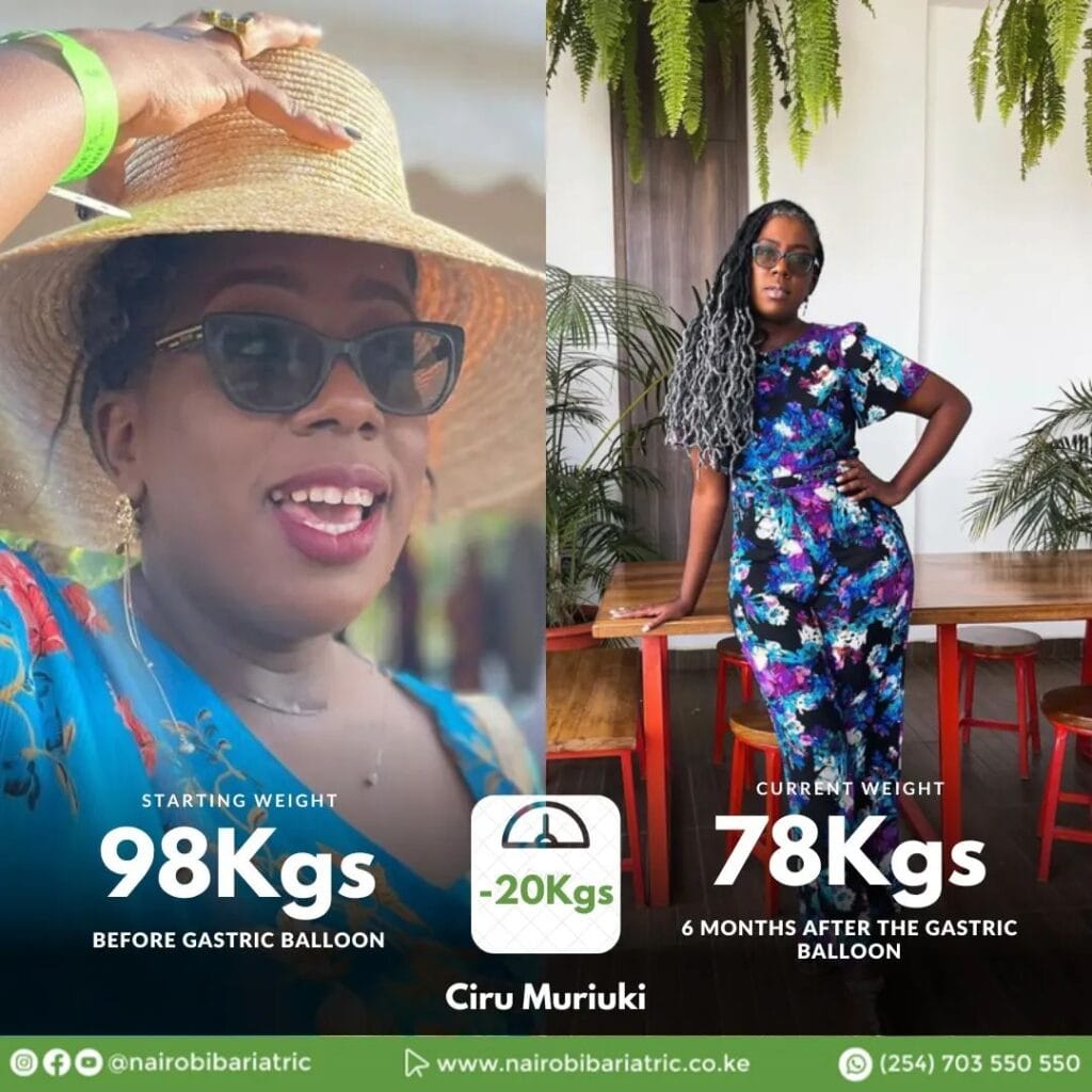 Ciru_Muriuki_Nairobi_Bariatric
