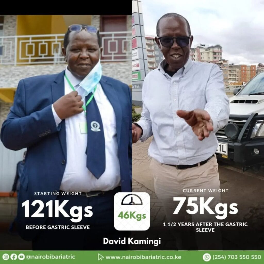 David_Kamingi_Nairobi_bariatric