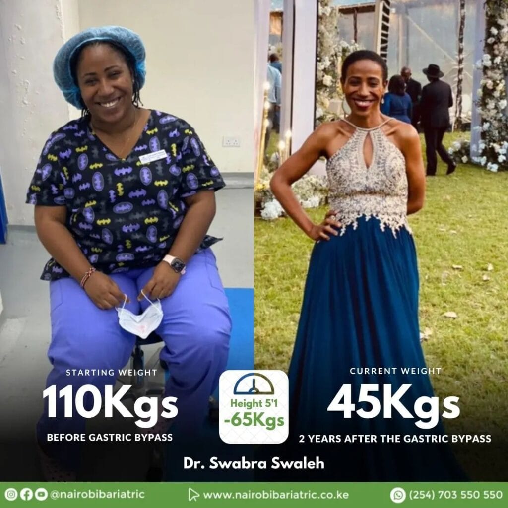 Swabra_Swaleh_Nairobi_Bariatric