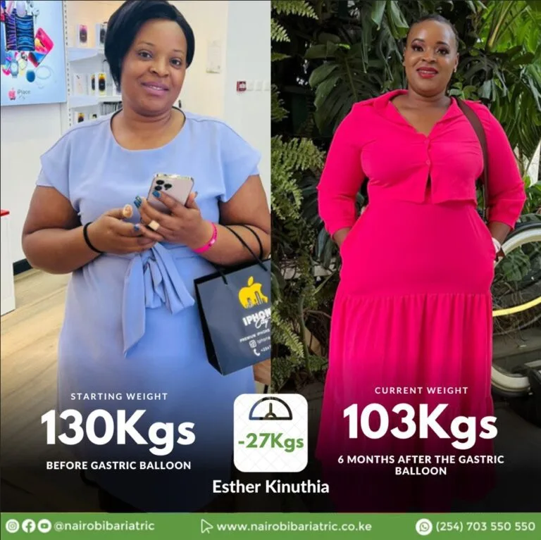 Esther_kinuthia_gastric_balloon